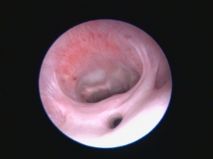 Endoskopiebild einer Hündin mit Blick auf die äußere Harnröhrenmündung und Vagina